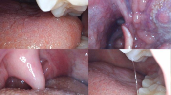 Tickling in the throat Head and foot_pillory ( HD ).webp