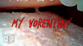 My Vorentiny.webp