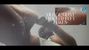 Village Giant Cracked Feet Flakes Rain On Tinnies.webp