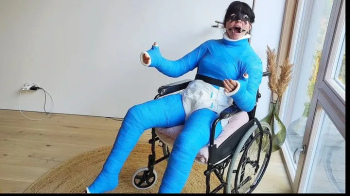 Weeks in a Full body cast.webp
